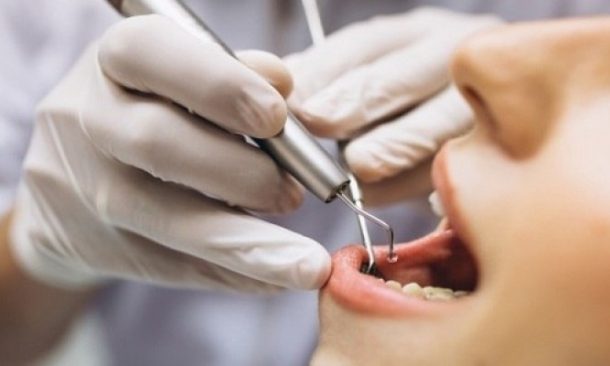 De dor a tumor: as complicações causadas pelo dente do siso   Notícias   R7 Saúde